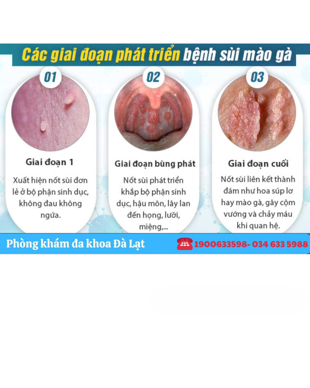 Block Image